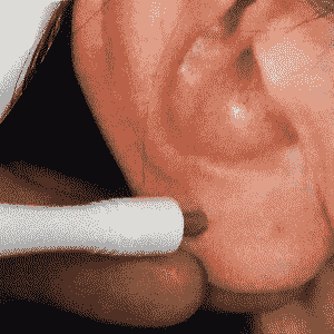 Зубная боль. ТОчки № 5 (на фото) и 6. ДЭНАС ПКМ | НЕЙРОДЭНС. 