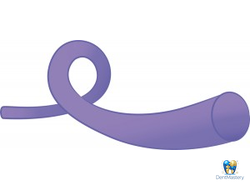 Монофиламентный рассасывающийся шовный материал МедПГКЛ-М 1,5 USP – высокопрочный, мягкий, минимальная травма тканей, аналог KAPROFYL