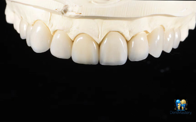 Yucera HT White Zirconia – Прозрачный и Прочный Цирконий для Стоматологии