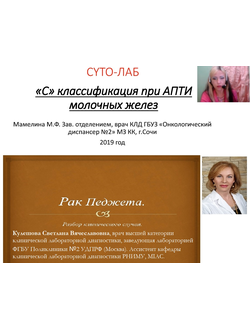 Цитологическая картина опухолевых поражений молочной железы (продолжение)