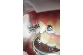 ОРТОДОНТИЯ