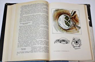 Краснов М.М. Микрохирургия глауком. М.: Медицина. 1974г.