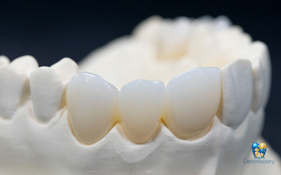 YUCERA 4D Pro Zirconia - Инновационный цирконий с четырьмя измерениями