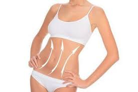 Abdominoplastie pour un ventre plat