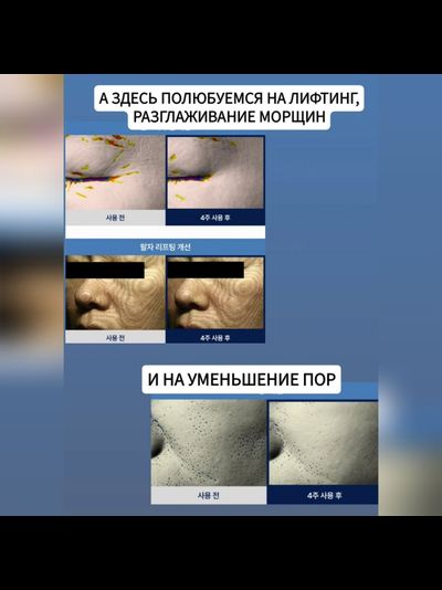 PHI Лифтинг маска Паутина с ботокс эффектом 4 шт.