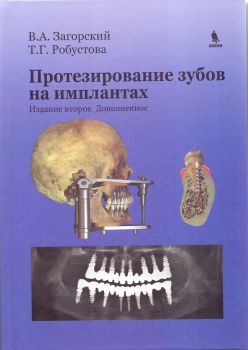 Протезирование зубов на имплантатах. 2-е издание, доп. Загорский В.А., Робустова Т.Г. &quot;БИНОМ&quot;. 2016