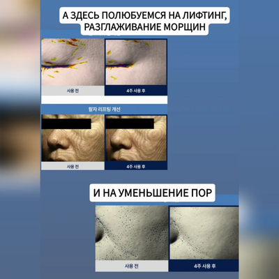 PHI Лифтинг маска Паутина с ботокс эффектом 4 шт.