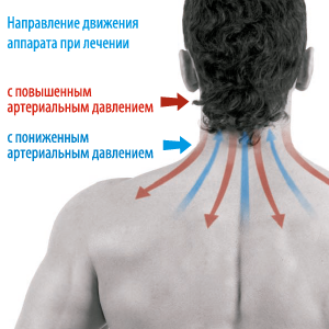 Направление перемещения аппарата. Дэнас ПКМ | Нейродэнс. 