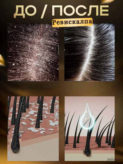 Ревискалп от перхоти