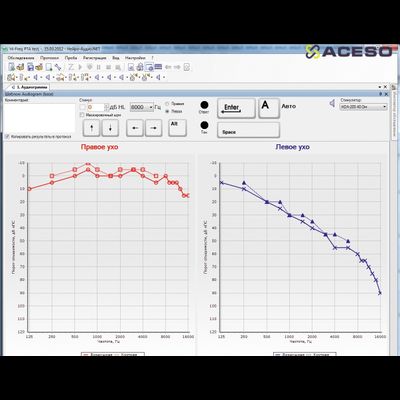 Нейро-Аудио/СВП 2-канальный прибор для проведения объективной аудиометрии (КСВП)