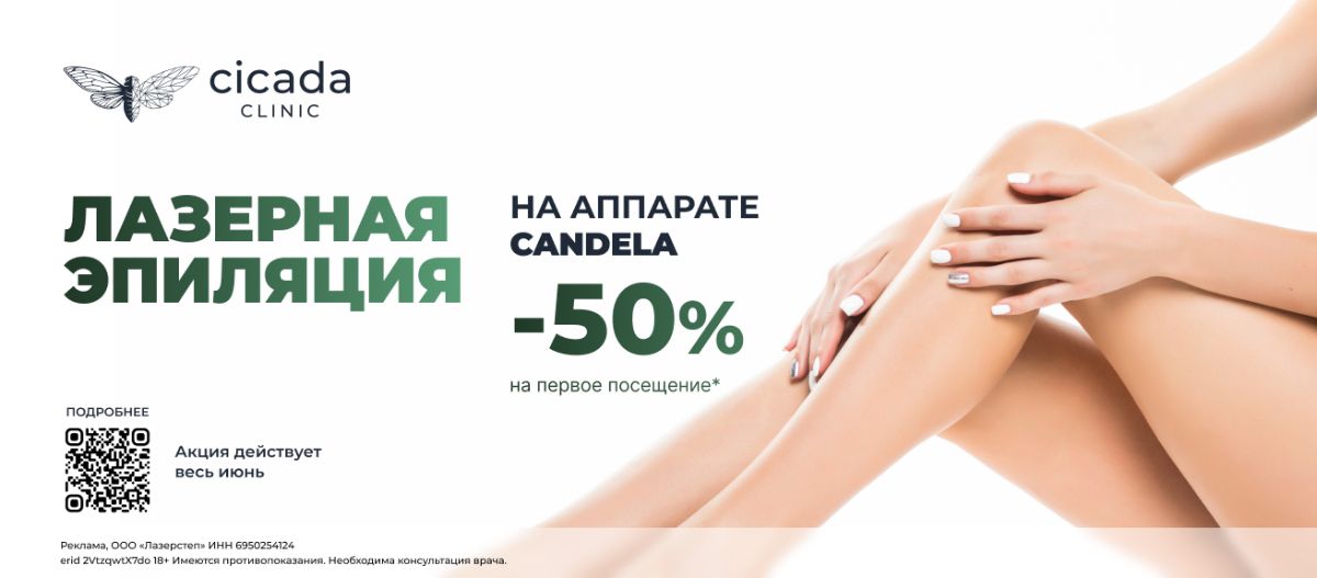 ЛАЗЕРНАЯ ЭПИЛЯЦИЯ на Александритовом лазере - CANDELA
