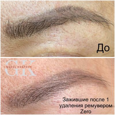 Zero Osmosis Ocean (Осмос для кислотного ремувера)