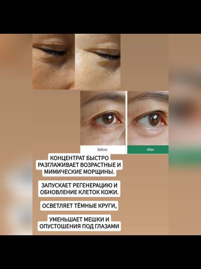 KREAM MILK Концентрат от мешков под глазами, для лифтинга и подтяжки нависшего века, разглаживания морщин 10гр.