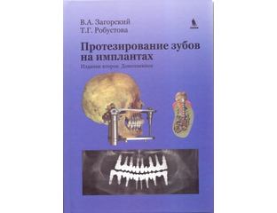 имплантация книги. имплантация книги. дентальная имплантация учебник. протезирование на имплантах книга. дентальная имплантология книга.