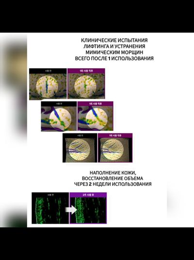 CENTELLIAN24 Лифтинг уход на основе запатентованных комплексов (тонер, эмульсия, крем + сыворотка "Эффект Золушки")
