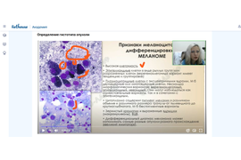 Цитологическая диагностика метастазов (онлайн курс)