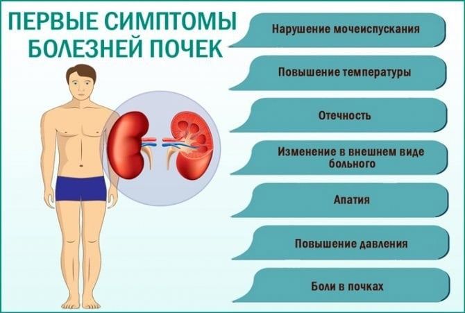 Где болят почки симптомы фото Нефрологический центр с отделение гемодиализа - Медикал Групп - Новости