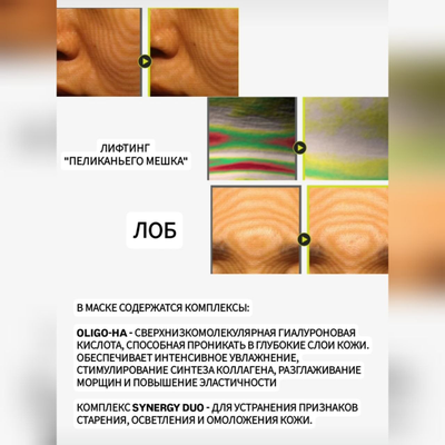 RE-MERGE Эксклюзивная маска - корсет от птоза, брылей, второго подбородка 4шт.