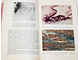 Грицман Н. Поражения сердца при коллагеновых заболеваниях. М.: Москва. 1971г.
