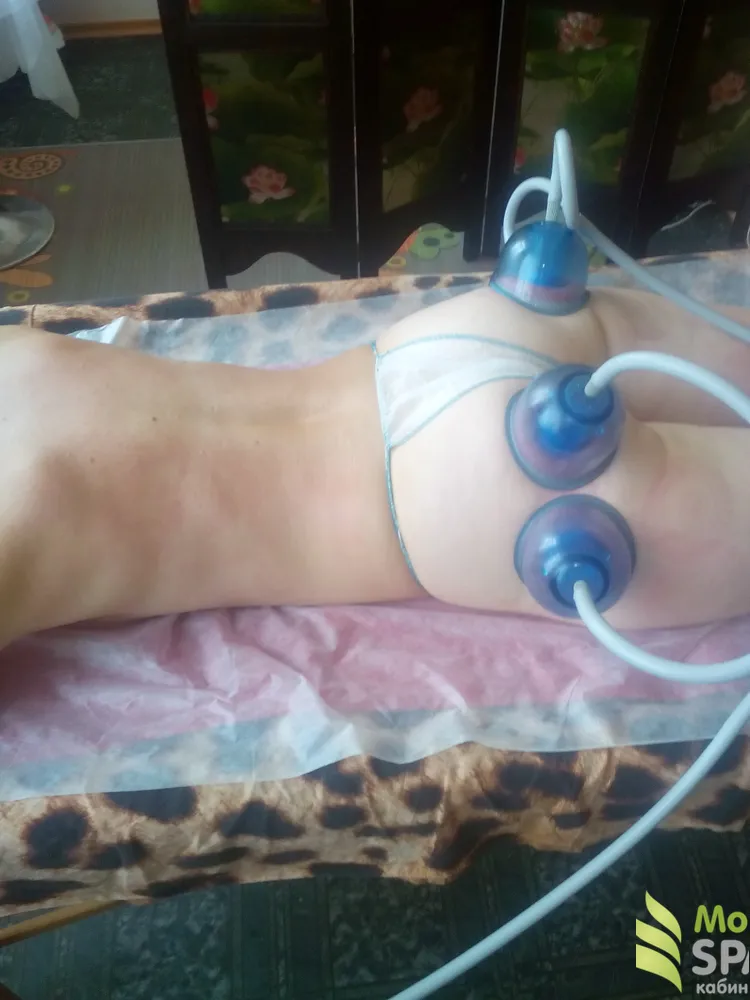 Процедура под названием "Бразильский идеал"! Дает заметную подтяжку кожи и приводит в тонус ягодичные мышцы!