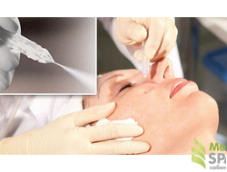 Аква - лифтинг (пилинг). 60 минут. Подробнее...