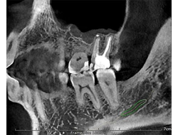 Papaya 3D 16x14 - компьютерный томограф без цефалостата Genoray Co., Ltd (Республика Корея)