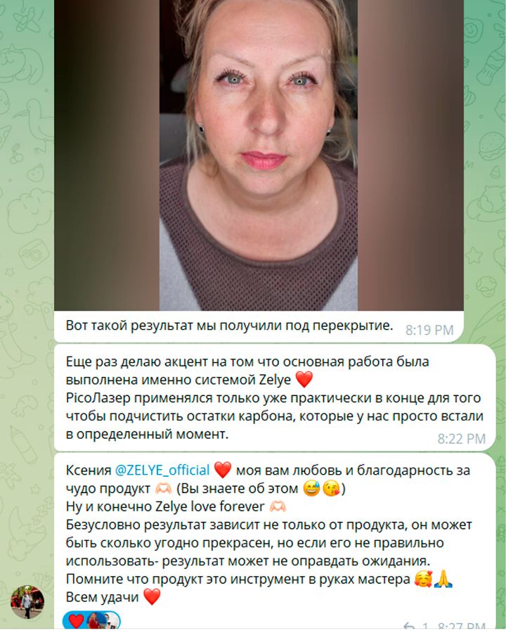 Результат удаления перманентного макияжа бровей под перекрытие. За какой срок можно удалить татуаж?