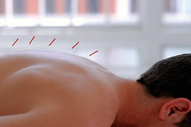 РЕФЛЕКСОТЕРАПИЯ