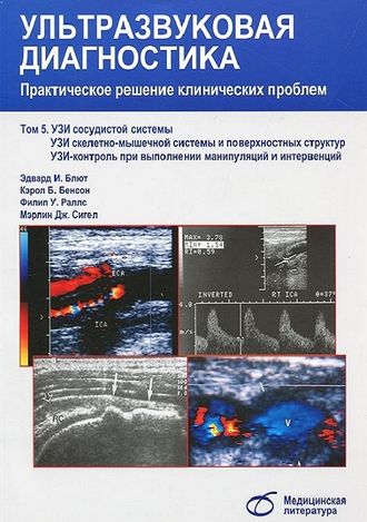 Ультразвуковая диагностика. Практическое решение клинических проблем. Том 5. УЗИ сосудистой системы. Узи скелетно-мышечной системы и поверхностных структур. УЗИ-контроль при выполнении манипуляций и интервенций. Блют Э.И. &quot;Медицинская литература&quot;. 2015.