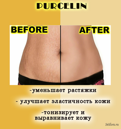 PURCELIN ОТ РАСТЯЖЕК НА КОЖЕ