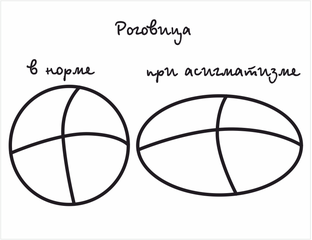 Купить контактные линзы для астигматизма в Ижевске недорого, низкие ...
