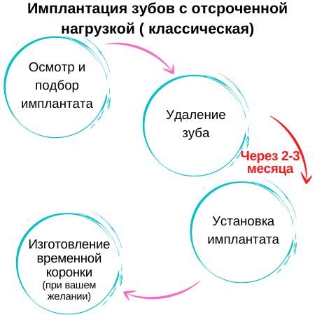 Классическая имплантация зубов отличие Адентал