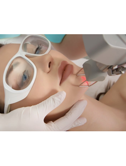 Фракционные СО2 лазеры