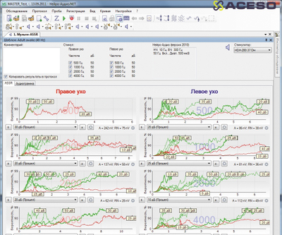 Нейро-Аудио 2-канальный прибор для проведения объективной аудиометрии КСВП, ОАЭ, VEMP, ASSR, ЭКохГ