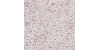 Жидкие обои Silk Plaster Рельеф (Relief) 331