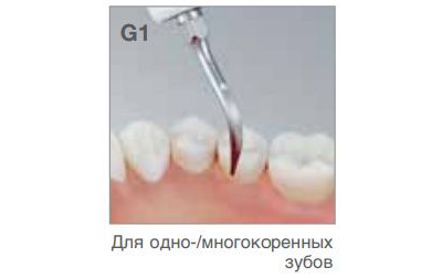 Насадка G1  к ультразвуковому скалеру Varios NSK/Satelec