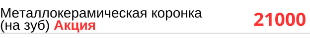 Металлокерамическая коронка на зуб цена в Новосибирске, прайс