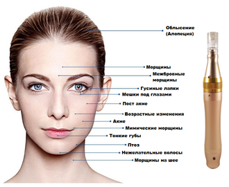 Дермапен с аккумулятором Dermapen MyM аппарат фракционной мезотерапии + 2 шт. насадки в подарок