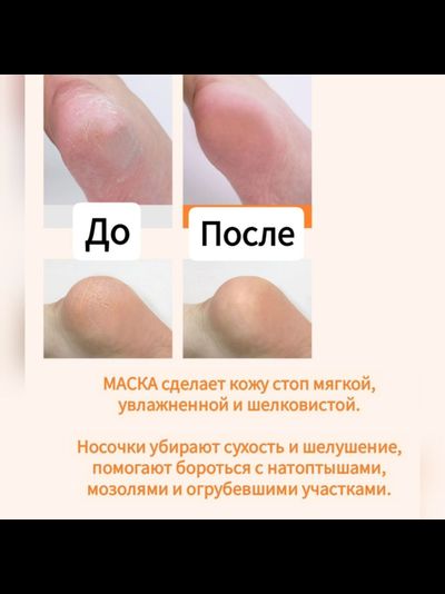 PETITFEE Маски с сухой эссенцией для смягчения кожи ног 5 пар
