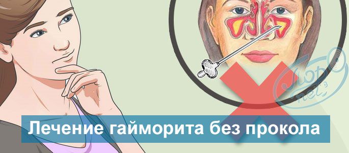 Лечение гайморита без прокола, гайморотомии в Красноярске - Лор-нэт