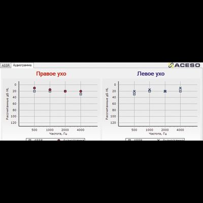 Нейро-Аудио 2-канальный прибор для проведения объективной аудиометрии КСВП, ОАЭ, VEMP, ASSR, ЭКохГ