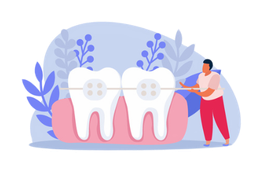 Исправление прикуса (брекеты)