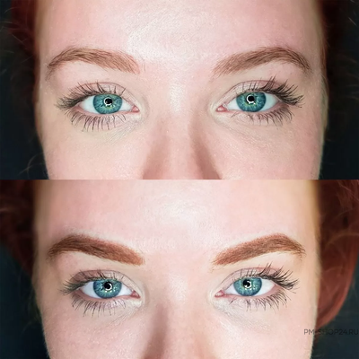 Брови. Веснушка