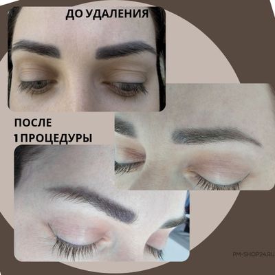 Щелочной сет для удаления пигмента Zero Lagoon