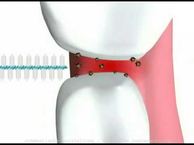 Межзубные ершики стандартные цилиндрические 0,82 мм, Interdental Brush Regular, Biorepair, 5 шт.