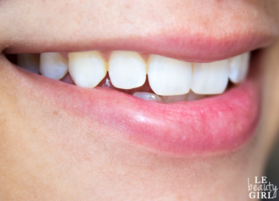 Ополаскиватель для полости рта с антибактериальным, противовоспалительным и ранозаживляющим действием Antibacterial, PresiDENT, 250 мл.