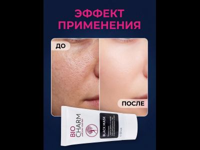Черная маска от черных точек и прыщей, гелевая 50 мл.