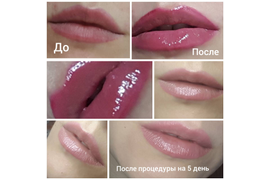 Nano tatuaj buze - Перманентный татуаж губ