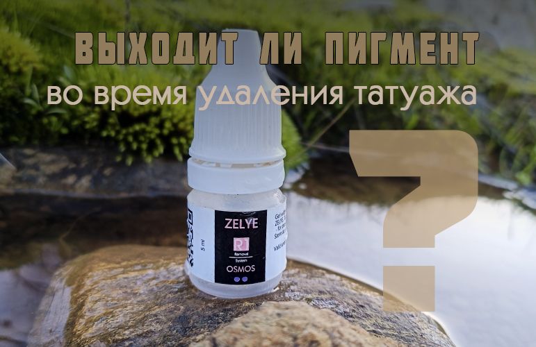 ВЫХОДИТ ЛИ ПИГМЕНТ ВО ВРЕМЯ УДАЛЕНИЯ ТАТУАЖА?