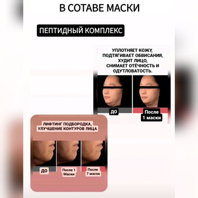 RE-MERGE Эксклюзивная маска - корсет от птоза, брылей, второго подбородка 4шт.